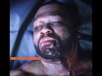 a man with blood on his face laying in a bed